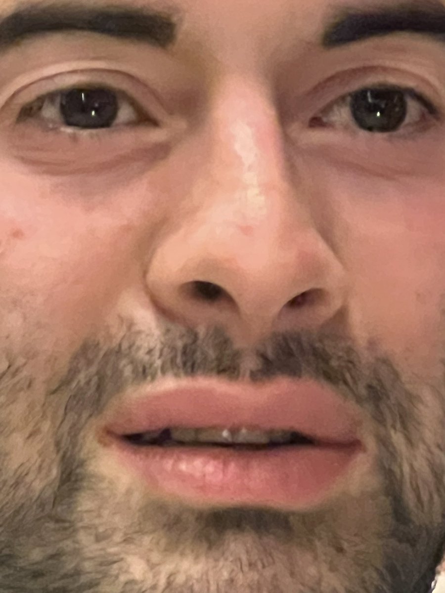 mfw i overslept &amp; didn’t get to mint a sloth