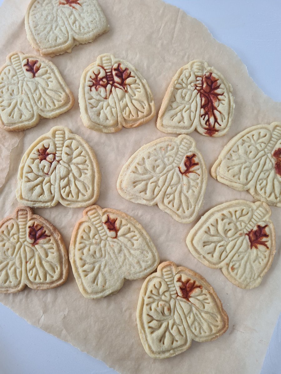 TB themed biscuits for our #tuberculosis awareness day @NorthMidNHS today. TB continues to make people unwell and can be passed from one person to another through coughing but transmission is preventable and the illness curable with antibiotics. Early diagnosis= better outcomes.