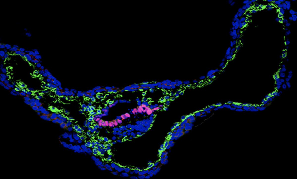 Fredrik Lanner (@fredrik_lanner) on Twitter photo Join my lab <a href="/karolinskainst/">Karolinska Institutet</a> for PhD studies in Early human embryo development, co-supervised by @simonelsasser and Andres Salumets!
kidoktorand.varbi.com/en/what:job/jo… Join my lab <a href="/karolinskainst/">Karolinska Institutet</a> for PhD studies in Early human embryo development, co-supervised by @simonelsasser and Andres Salumets!
kidoktorand.varbi.com/en/what:job/jo…