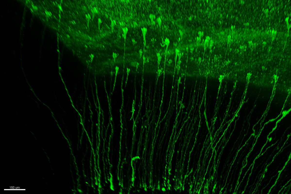 Científicos del Instituto de Neurociencias (@NeuroAlc CSIC-UMH) descubren la implicación de linajes paralelos de células madre en la creación de neuronas. Este hallazgo supone un gran paso hacía un mayor conocimiento del proceso de creación de neuronas. ➡️csic.es/es/actualidad-…