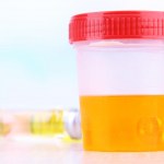 Here's my Substack article for the day: Why SPRAYING YOUR URINE in your neighborhood is NOT a good tactic to recover a lost pet (nor is the kitty litter myth)! armedrobbers2airedales.substack.com/p/dont-use-pee…