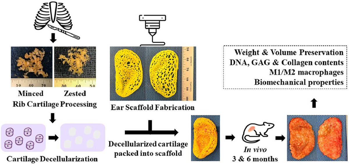 📝Read 'Bioengineering Full-scale auricles using 3D-printed external scaffolds and decellularized cartilage xenograft,' recent work from James Shin (@shinisterMD) in 'Acta Biomaterialia' (@ActaBio), here👉tinyurl.com/y34e8eat