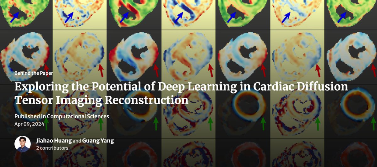gyangMedIA's tweet image. Exploring the Potential of #DeepLearning in #Cardiac #DiffusionTensorImaging #Reconstruction 
communities.springernature.com/posts/explorin…