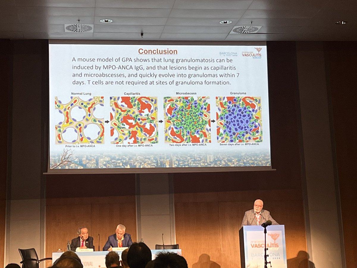 Verónica Coll Brito (@veronicacoll) on Twitter photo Lung Granulomas in Murine GPA are Induced by MPO-ANCA and Begin as Microabscesses that Evolve into Granulomas
👉🏼 Complement is not involved in the pathogenesis of pulmonary granulomas
<a href="/VasculitisBCN24/">Vasculitis Workshop Barcelona #VasculitisBCN2024</a> cular Lung Granulomas in Murine GPA are Induced by MPO-ANCA and Begin as Microabscesses that Evolve into Granulomas
👉🏼 Complement is not involved in the pathogenesis of pulmonary granulomas
<a href="/VasculitisBCN24/">Vasculitis Workshop Barcelona #VasculitisBCN2024</a> cular