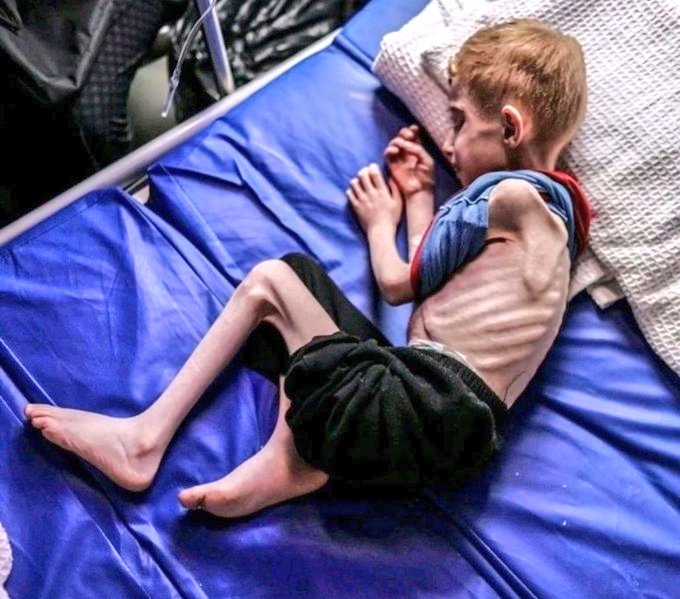 The United States and United Kingdom continue, in the face of this pure Evil, to provide Weapons, Cash and Political cover to the monsters doing this to innocent Children. This is the end of whatever remained of Western Moral 'Authority' Raise your voices against them.