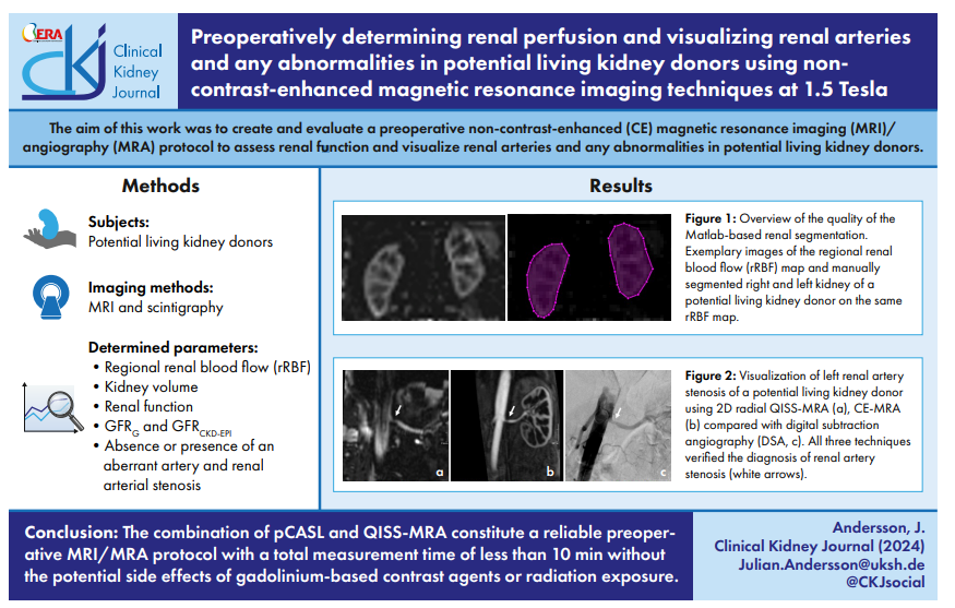 Preoperatively determining renal perfusion and visualizing renal arteries and any abnormalities in potential living kidney donors using non-contrast-enhanced magnetic resonance imaging techniques at 1.5 Tesla 🔓doi.org/10.1093/ckj/sf…