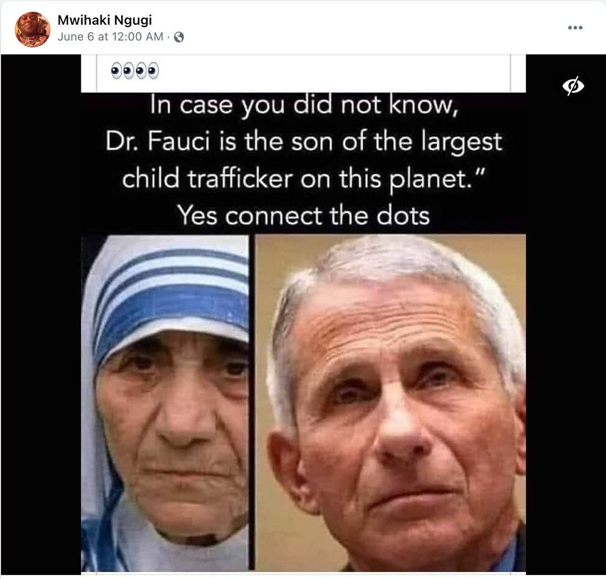 Anthony Fauci (Albanian) is likened to Joseph Mengele of the 21st century—an egregious deceiver, a mouthpiece for a sinister cabal. To understand who Dr. Fauci truly was, it's important to recognize his past. He was once dubbed the 'Son of Trans 'Father Teresa,' 'Mother…