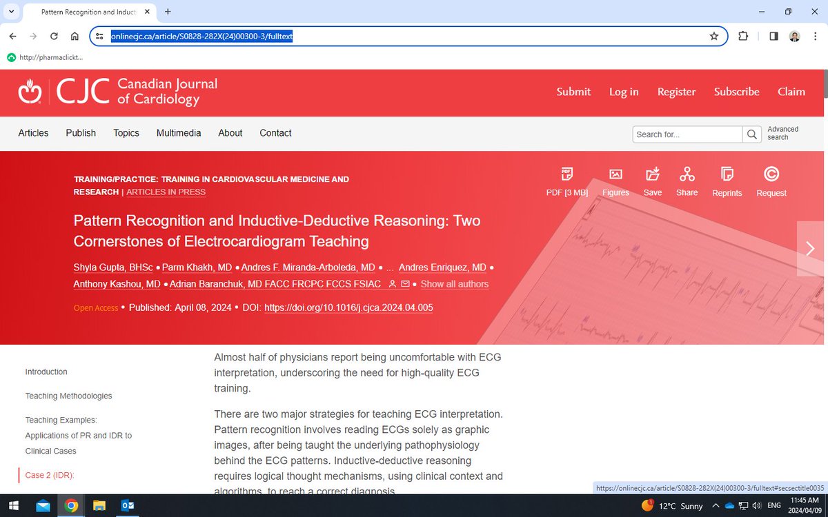 Paper of the day: Pattern Recognition and Inductive-Deductive Reasoning: Two Cornerstones of Electrocardiogram Teaching. onlinecjc.ca/article/S0828-… @shyla_gupta @andresenriqueza @JorgeERomeroMD @TheEKGGuy @andres_miranda4 @ManlioMarquez