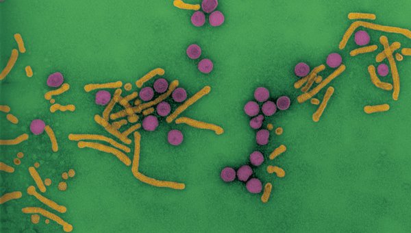 Le MOOC 'Viral Hepatitis' de l'@institutpasteur est disponible. Vous découvrirez les développements les plus récents sur la structure des virus et de leur physiopathologie, ainsi que l’épidémiologie et l’évolution clinique des différents types d’hépatite fun-mooc.fr/fr/cours/viral…