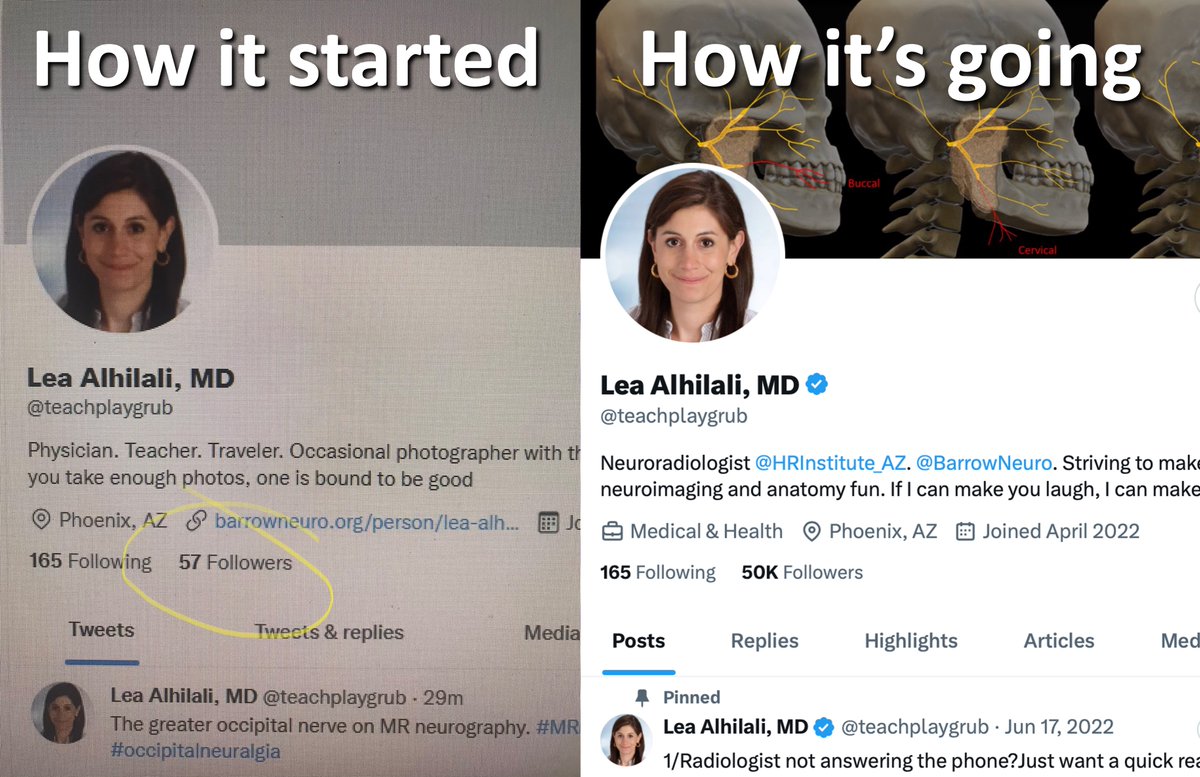 They say life begins at 50! If so, I’m just getting started! Getting 50k followers in <2 yrs is amazing, but was never my goal—teaching is & always will be Thank u all for helping me teach far & wide.I try to make each post worthy of your follow! X-cited for the road ahead!