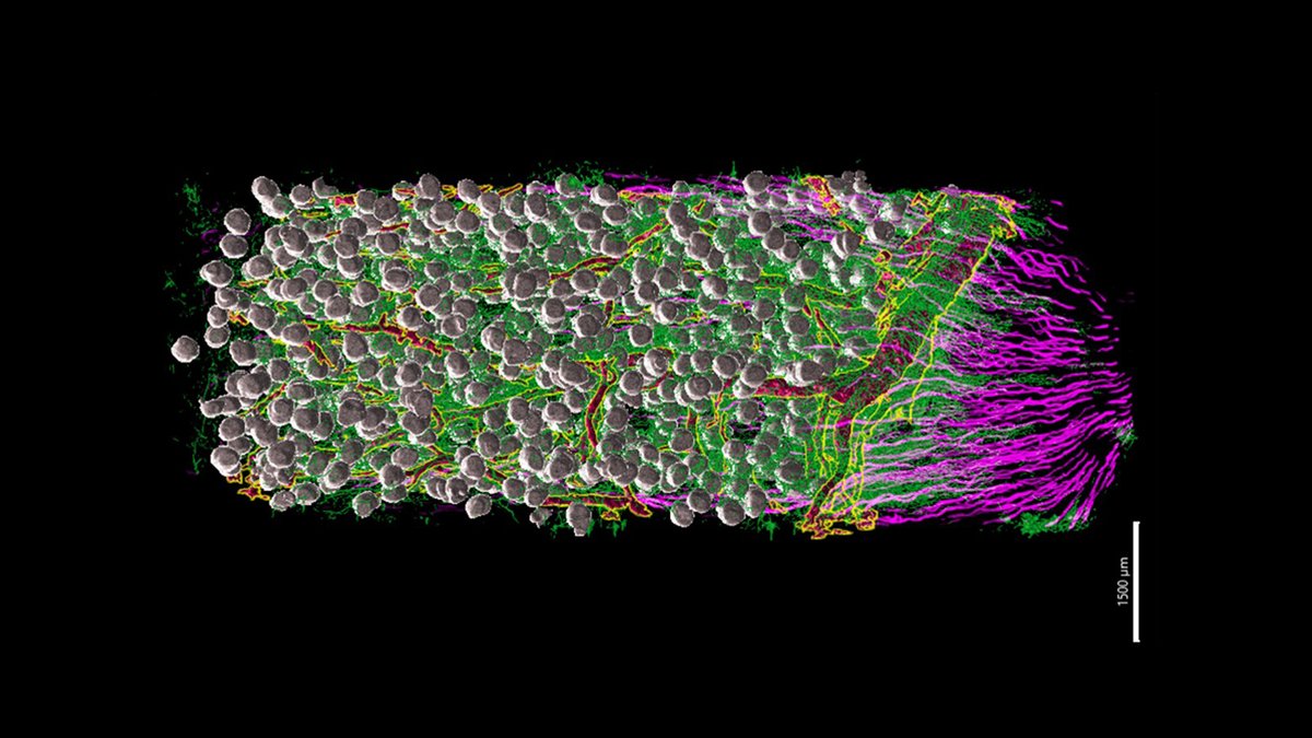 Out of the kidney-ness of our hearts, here is a #lightsheet image from #_hubmap researcher Liam McLaughlin @Jain lab @WUSTL of the renal pyramid of a kidney. This image shows arteries & other vessels bringing blood to the nerves & glomeruli throughout. It's un-bean-lievable!