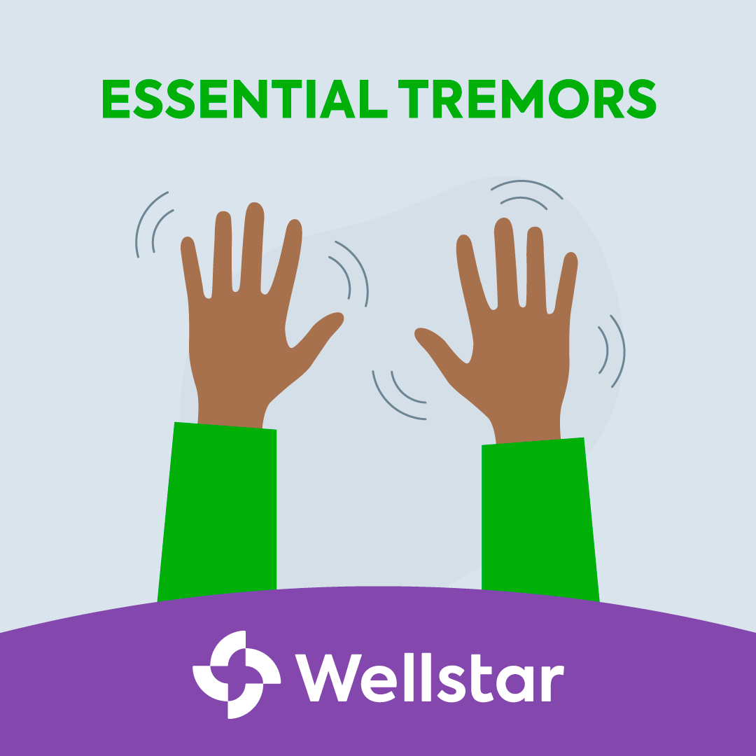 Essential tremor causes a trembling in the hands, head, voice, legs or torso. Wellstar provides functional neurosurgery services to treat essential tremor. Learn more at spr.ly/6010wbfNp.