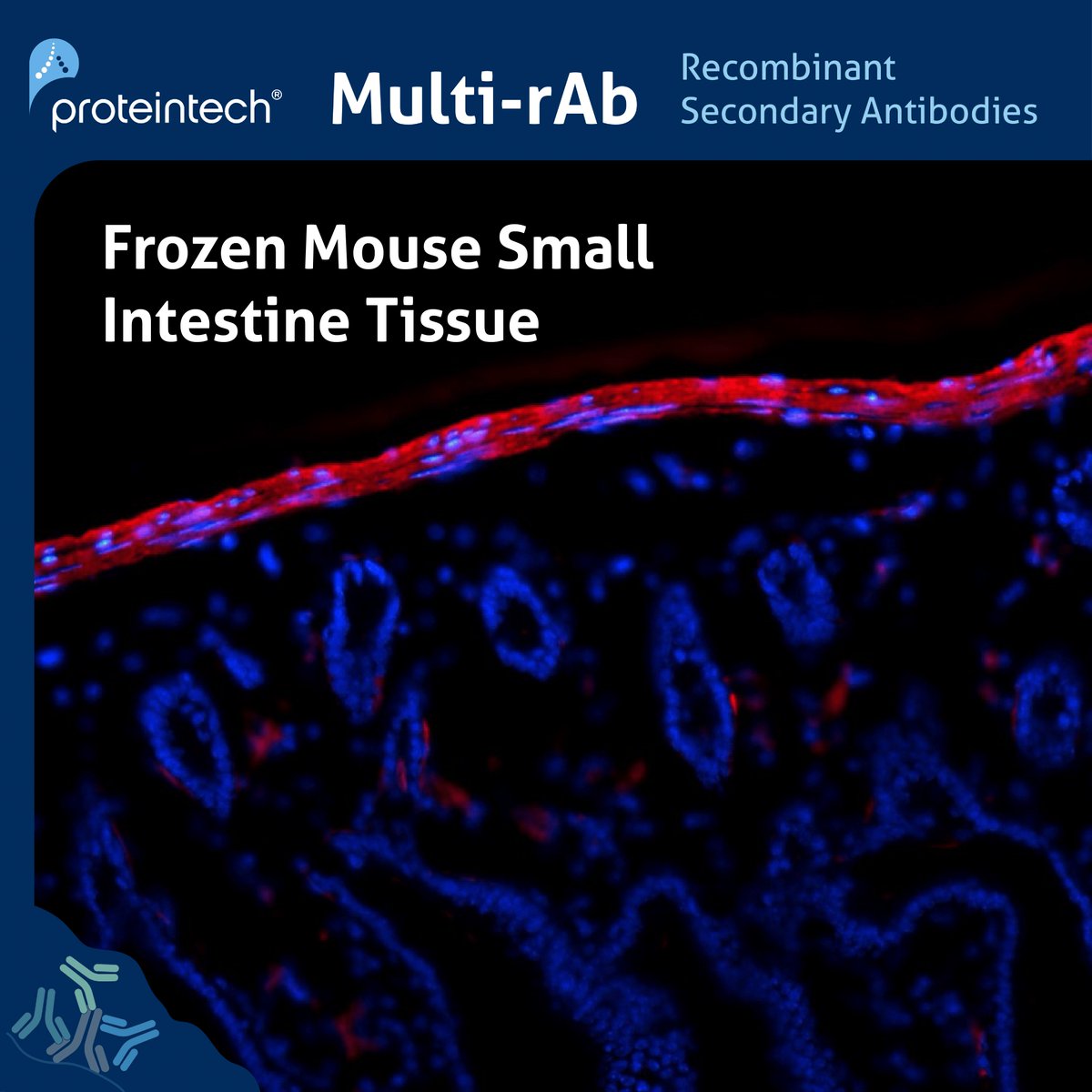 Whether you are using frozen or FFPE tissue samples, chromogenic or fluorescent detection, our Multi-rAb recombinant secondaries are designed to deliver the highest level of performance in all IHC applications. Visit us at AACR (Booth 914) to learn more: ow.ly/imtQ50RaNG1