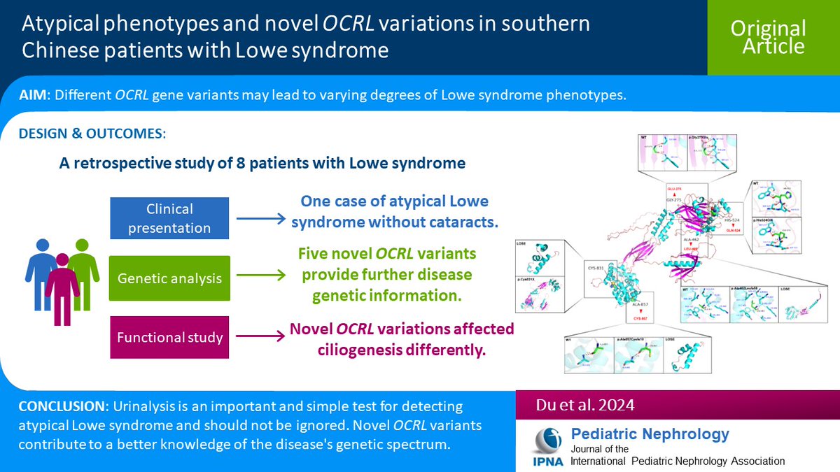 Lowe syndrome is characterized by congenital cataracts, psychomotor retardation & dysfunctional proximal renal tubules. Read this Original Article on atypical phenotypes & genetic characteristics of 8 children w/Lowe syndrome in southern China. link.springer.com/article/10.100…