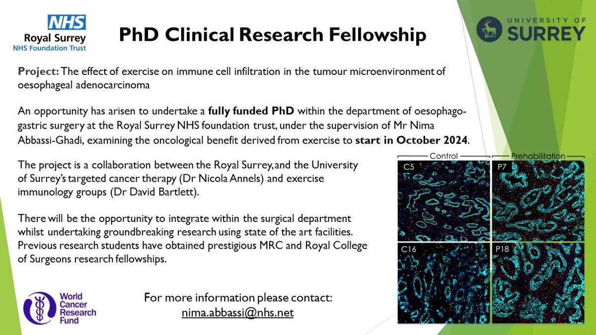 An excellent opportunity to undertake a fully funded basic science PhD (for surgeons in training) investigating the role of exercise in oesophageal cancer @RoyalSurrey and @UniOfSurrey starting October 2024. Please contact me directly if you are interested.