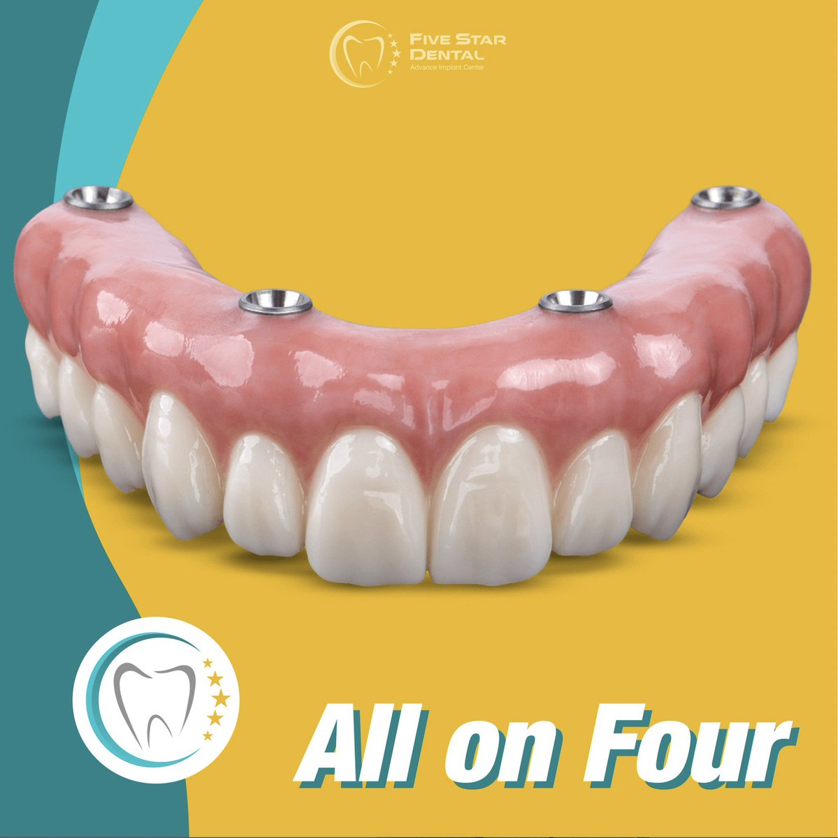 #DentalReconstruction #ProfessionalDentalCare #dentist #dentalhealth #dentalcare #dentistry #dentalclinic #dental #dentistrylife #losalgodones #yuma #somerton #lasvegas #utah #phoenix #losangeles #tucson