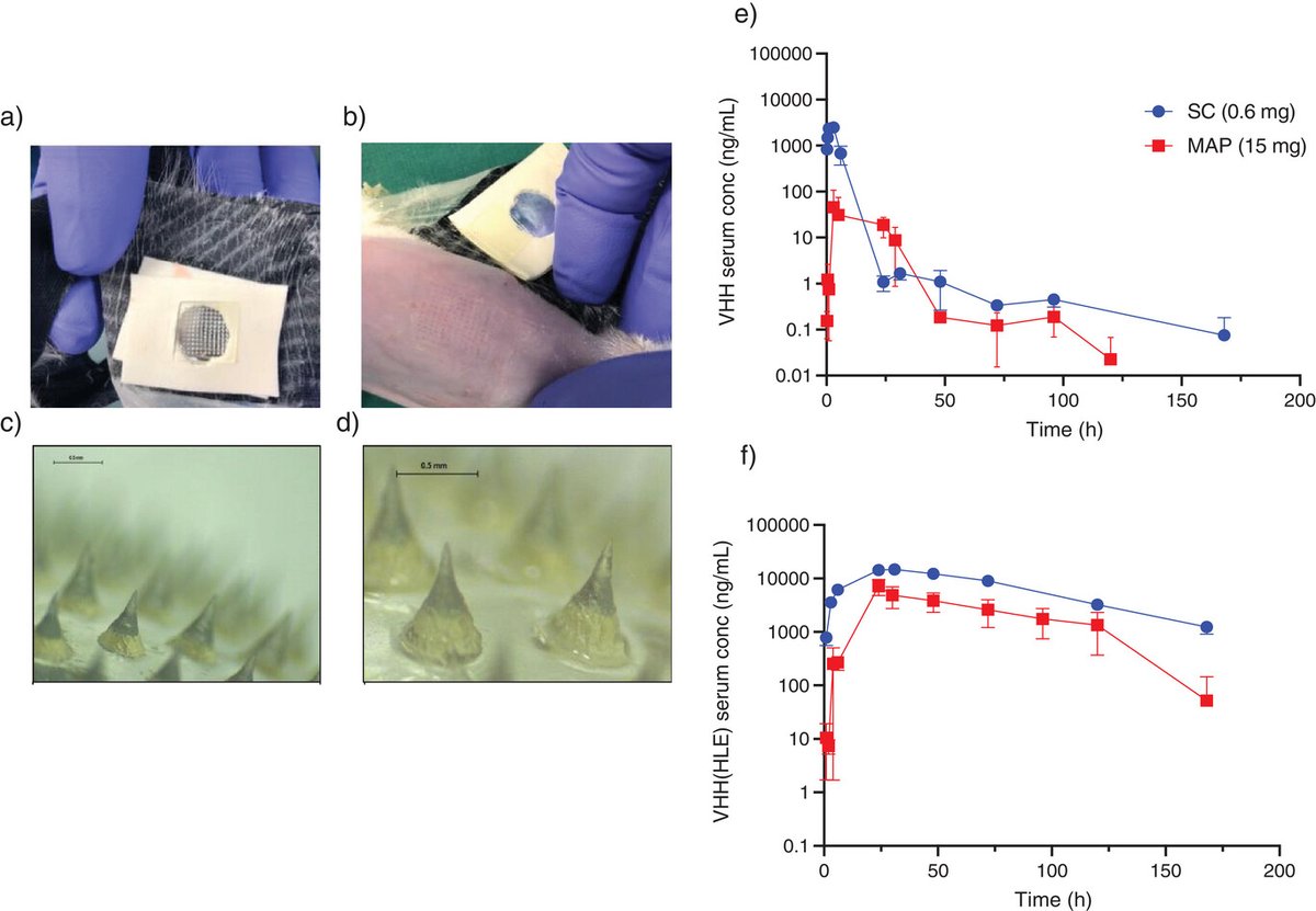 Paper Bonanza part 4: onlinelibrary.wiley.com/doi/10.1002/ma… Great collaboration with Ablynx to deliver their highly promising Nanobody therapeutics using hydrogel-forming microneedles! @Aaron_Hut @pharmacyatQUB @CRS_FG_SkinMuco #lovequb