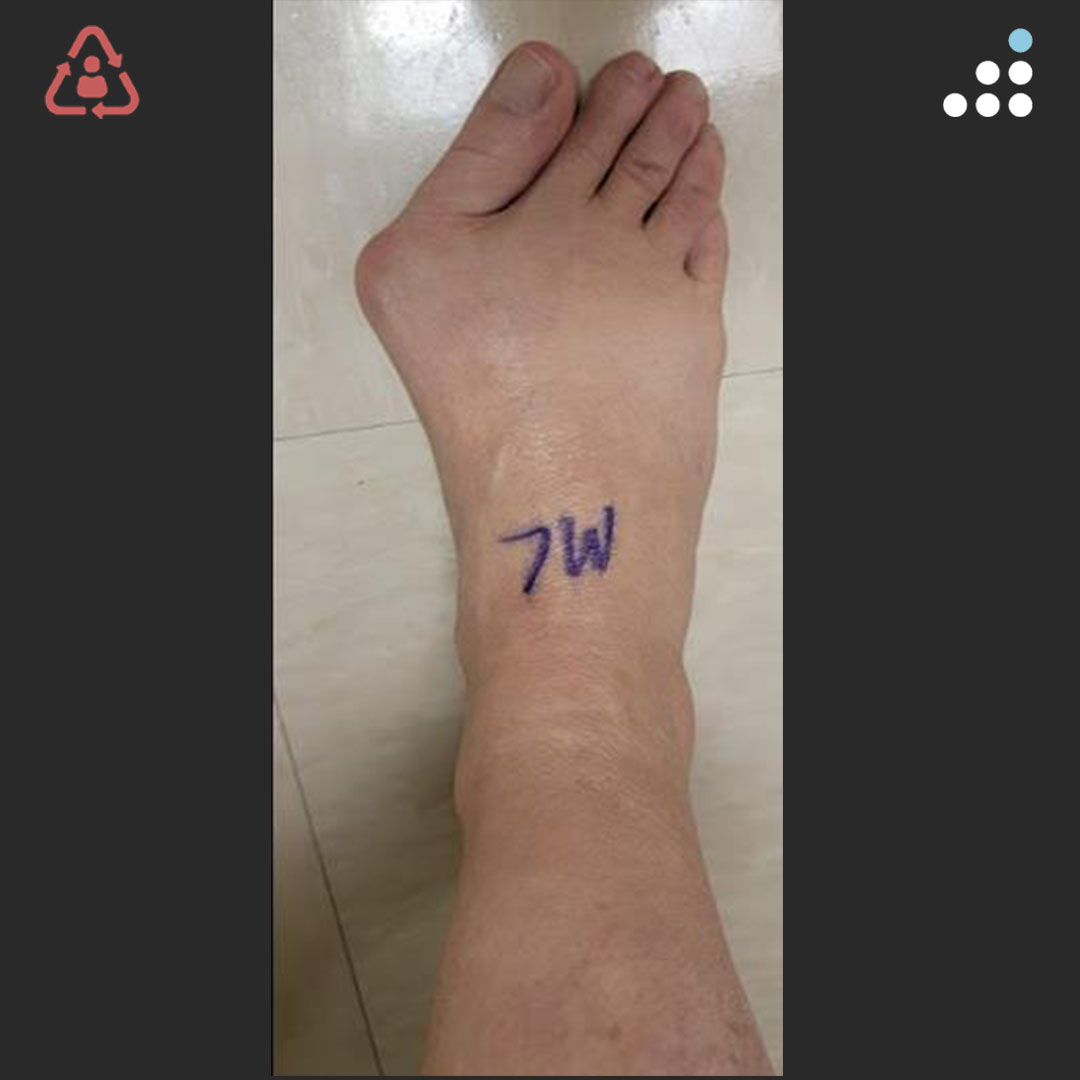 Orthobullets tweet media