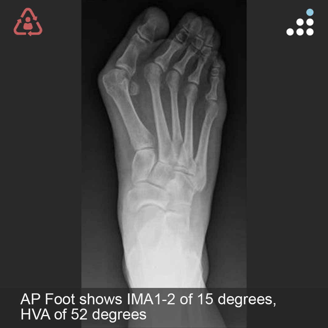 Orthobullets tweet media