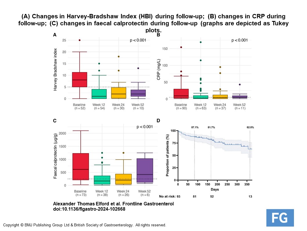 Check out latest study by Elford et al. on the real-world effectiveness of Upadacitinib in Crohn's disease. Their findings underscore Upa as a promising rx option for medically refractory CD link: bit.ly/4aMZSvJ @AlexElford3, @PlevrisN, @DrNickKennedy @MohsenSubhani
