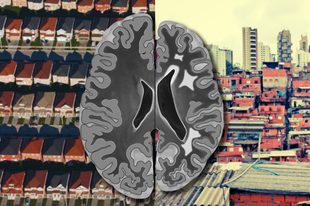 Regardless of income or education, people living in disadvantaged neighborhoods show early signs of #CognitiveDecline, according to a new study out of the lab of Drs. Avshalom Caspi & Terrie Moffitt of @DukePsychNeuro & Duke Psychiatry.
ow.ly/xubh50QTGO4
@DukeMedschool