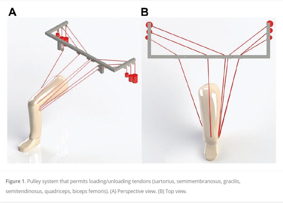 Very interesting French biomechanical data looking at the contribution of the medial hamstrings to knee stability. The medial hamstrings are most important when there is concomitant medial injury to the POL! #multiligamentknee #ACL See more here! journals.sagepub.com/doi/full/10.11…