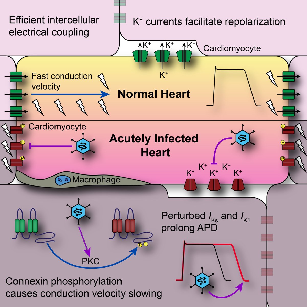 Padget & colleagues found a direct link of #viral infection to #arrhythmogenic potential before significant host #inflammatory responses and/or myocardial damage. Learn more at ahajournals.org/doi/10.1161/CI… @rae_padget @poelzing_lab @D_RyanKing