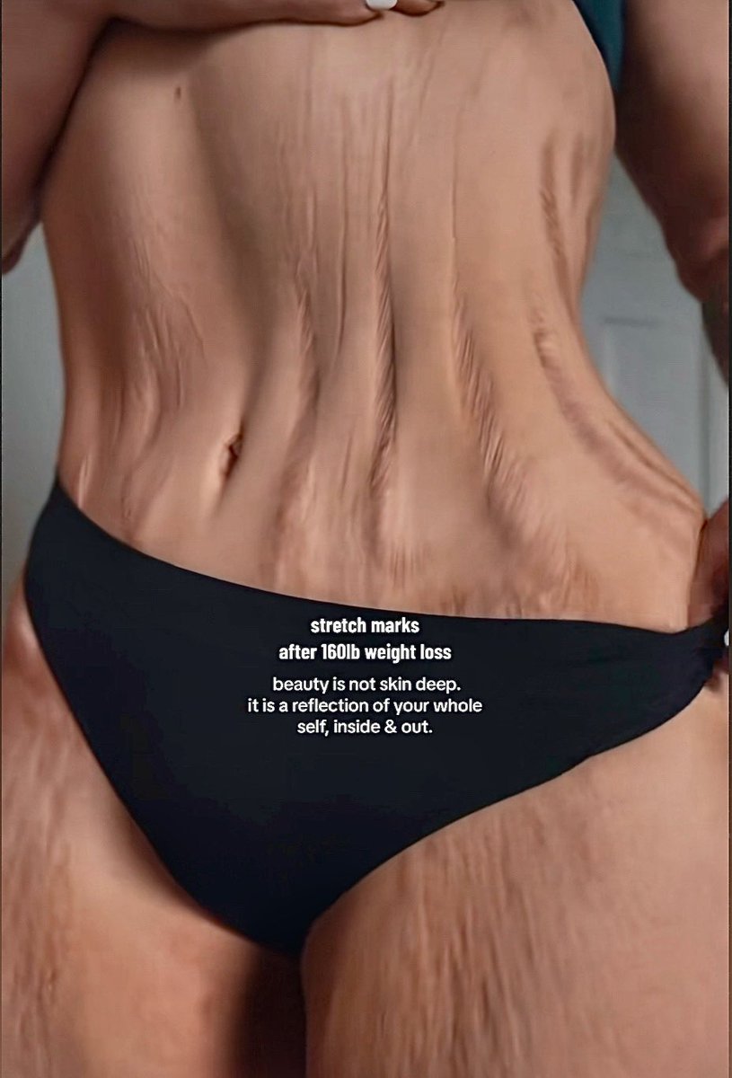 Jürg «der Fuetsch» Mösli tweet media