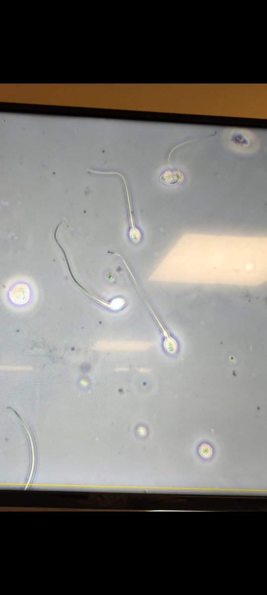 Sample : Urine
Male, 14 years.
Test : Urine microscopy.

Will you report this ?