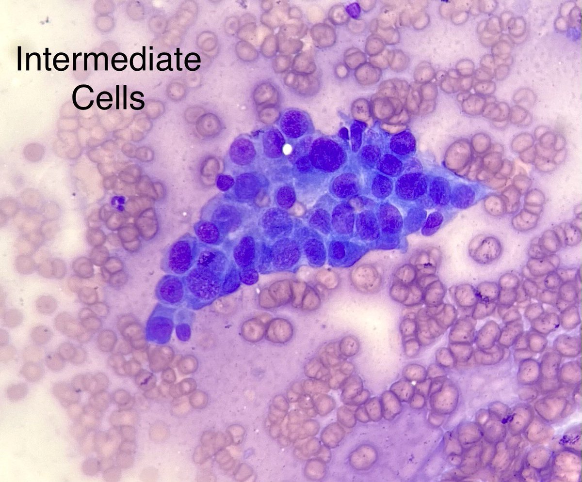 3 cell types and the coolest sounding Gene out there - read about it below 👇 #Cytopath #PathX #PathTwitter