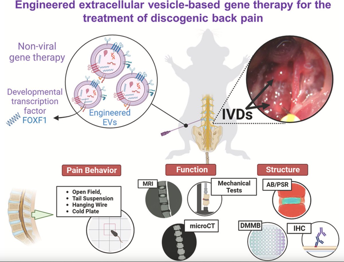 nhc_nanomedlab's tweet image. Thrilled to share our paper in collaboration with @PurmessurLab showing the therapeutic potential of engineered EVs loaded with transcription factors to treat back pain.

sciencedirect.com/science/articl…

@OhioStateBME @OhioStateDHLRI @OSUGeneTherapy