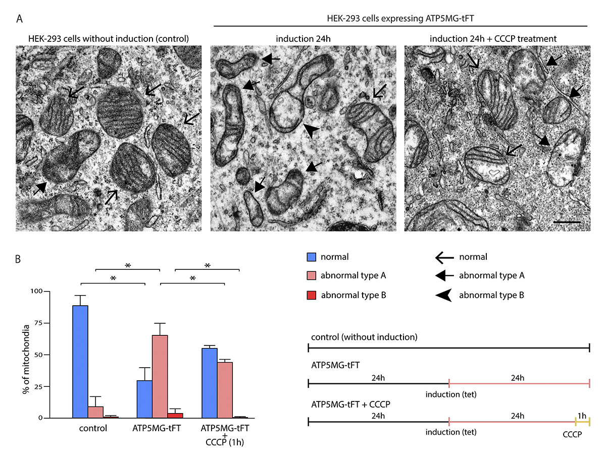 Krakowczyk, Bragoszewski @NenckiInstitute et al. discovered the unique ways human cells handle mitochondrial protein transport failures. They reveal a mechanism, distinct from fungi, where human cells rely on mitochondrial factors to clear blockages. hubs.la/Q02qM9-m0