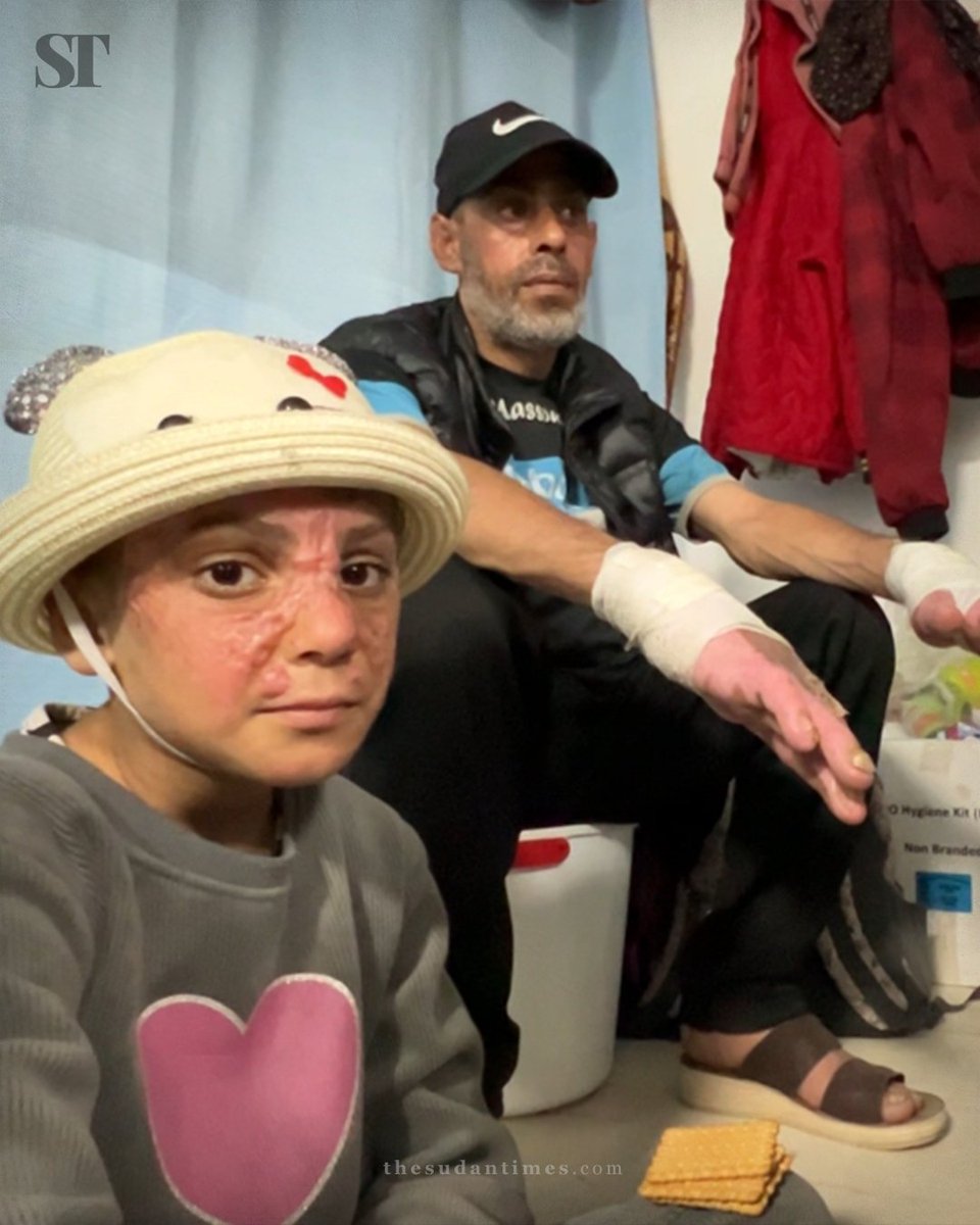 Seyma Garmud and her family members, whose homes at Jabalia refugee camp were targeted by Israel during its relentless attacks in Gaza and who were injured in the resulting fires.