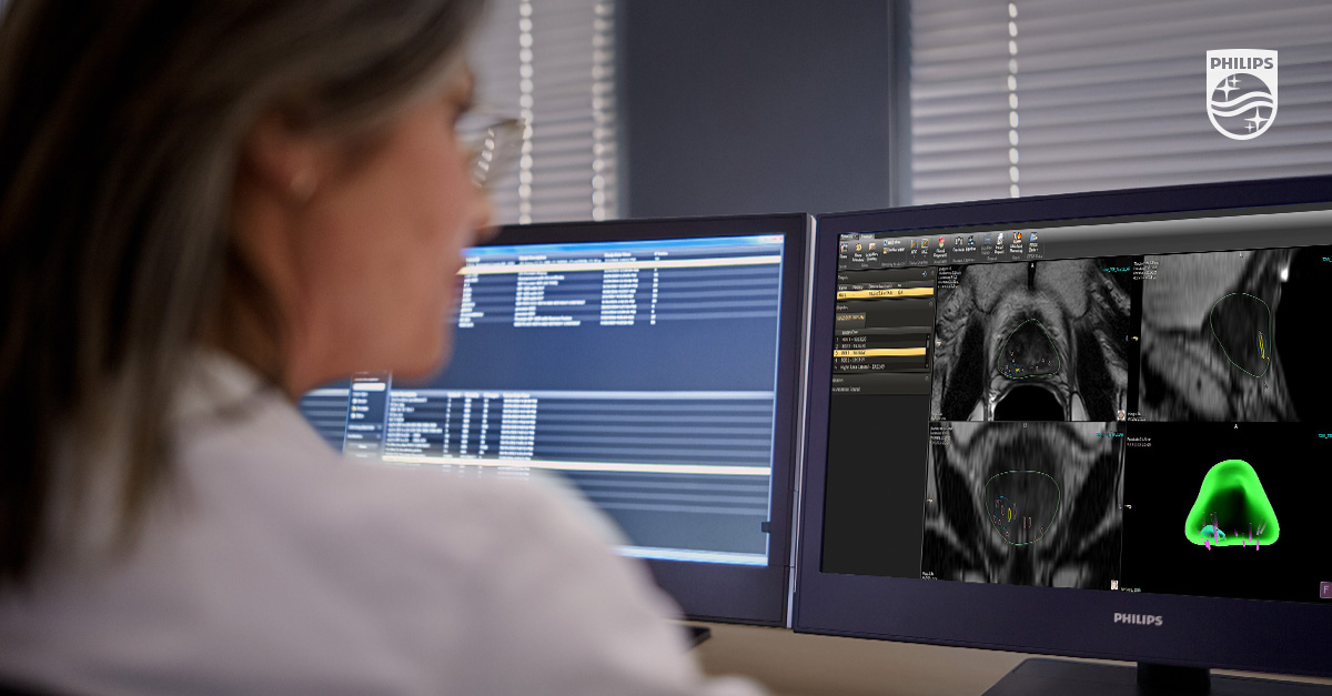 donbakerphilip1's tweet photo. Join us at #AUA23 in Chicago, April 28 - April 30! Philips will highlight its latest comprehensive prostate care solutions that help add clinical efficiency and enhanced collaboration across the care pathway. Learn more at: https://t.co/4Z1xr237UC https://t.co/HujZKJPFW3