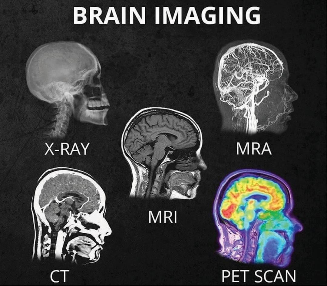 These are the different types of brain imaging methods used across the world.