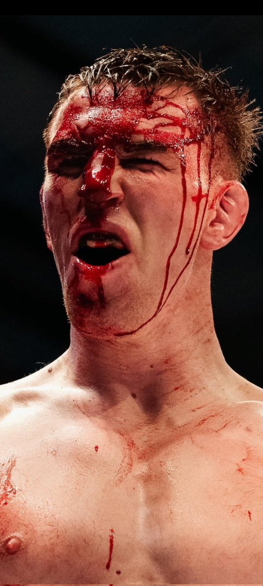 This is one of the most incredible stills I've ever seen in Irish MMA.

James Sheehan in the immediate aftermath of his title win at Cage Warriors Dublin this past weekend.