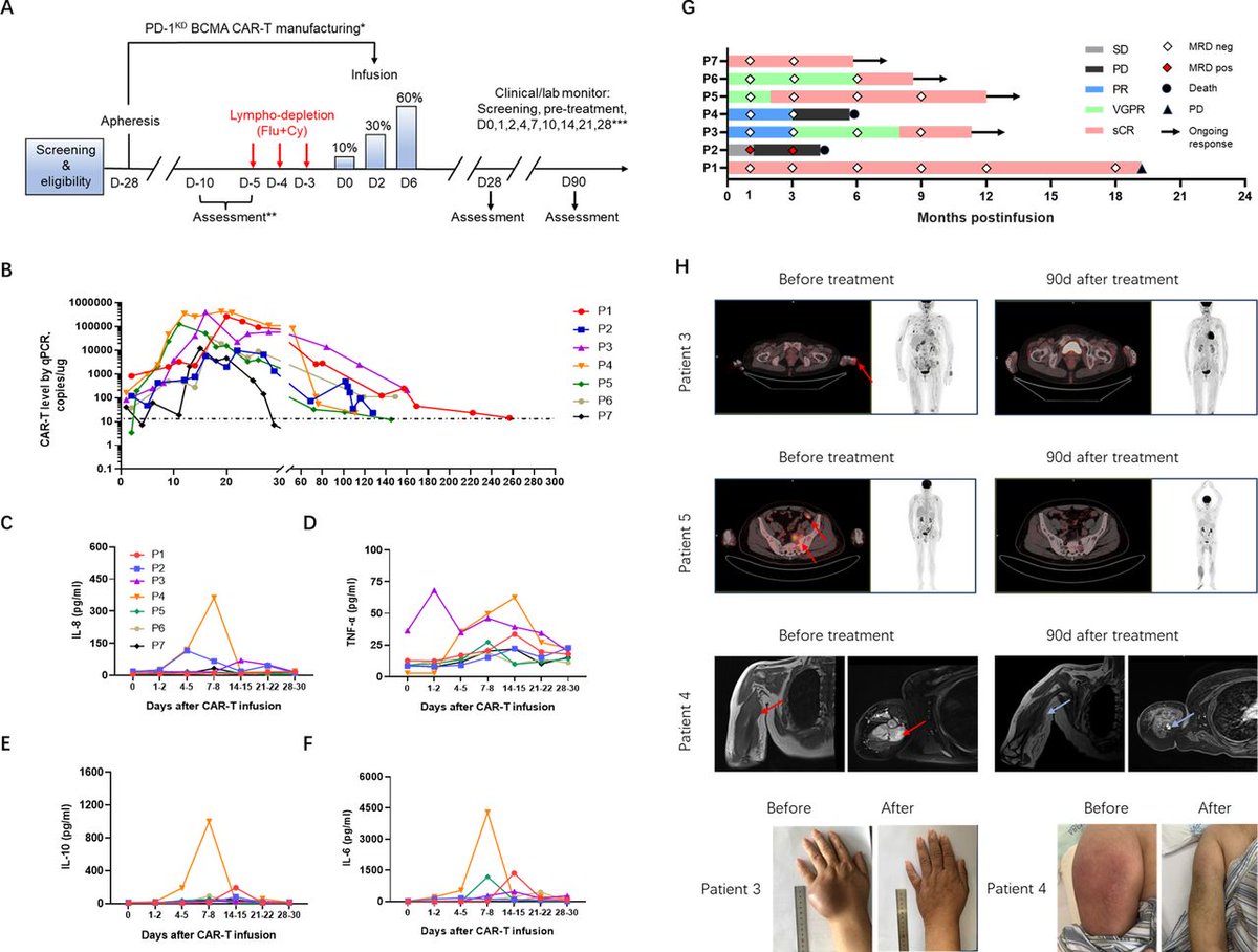 New #JITC article: PD-1 downregulation enhances CAR-T cell antitumor efficiency by preserving a cell memory phenotype and reducing exhaustion bit.ly/49vsOHi #AACR24