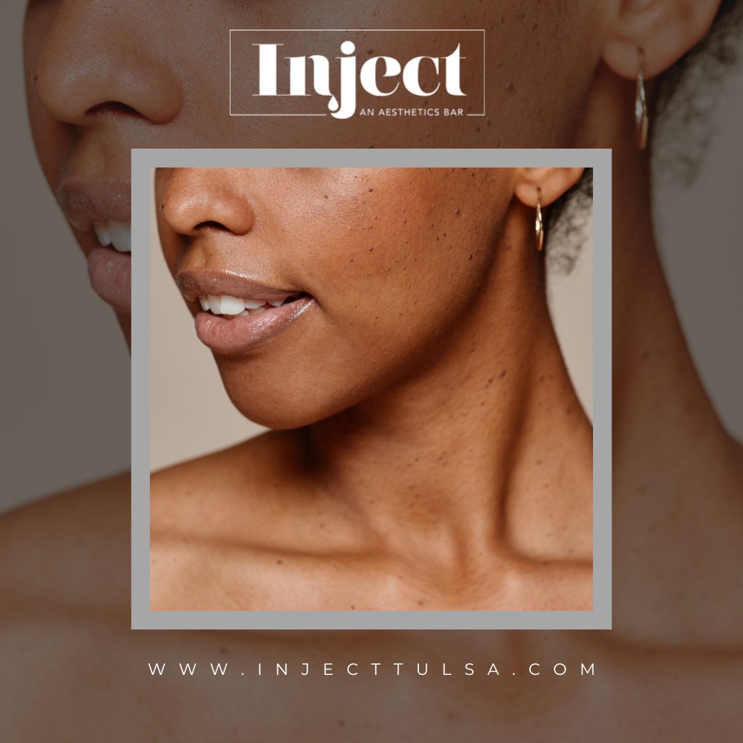 Experience the ultimate pampering session at Inject, where injections and hormone treatments meet for flawless results. 

#InjectTulsa #BeautyRevolution #TulsaAesthetics #LookGoodFeelGood #SkinGoals #HealthySkin #AestheticTreatments #RejuvenateYourself #BodyConfidence #Embrace...