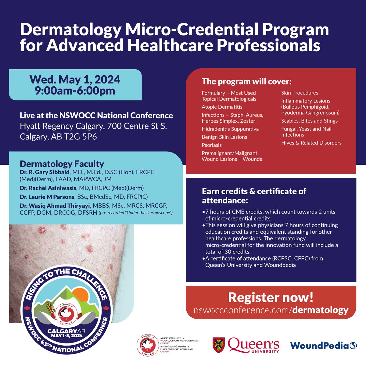 Join us for an exclusive one-day #Dermatology Program for Advanced Healthcare Professionals! Enhance your skills in diagnosing & treating dermatological conditions. 🗓 Wed, May 1, 2024 ⏰ 9:00AM - 6:00PM 📍 Hyatt Regency Calgary 🔗 Learn more & register: nswoccconference.com/dermatology
