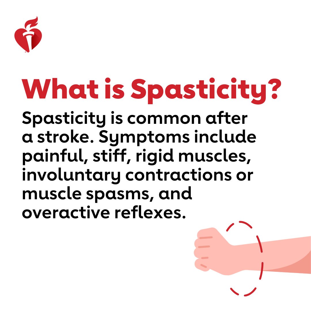 After a stroke, the brain and muscles might not communicate the same, causing spasticity. There is no cure, but early detection, medication and therapy can help relieve symptoms. @Ipsengroup is a proud sponsor of the @American_Stroke’s Spasticity Education Initiative.