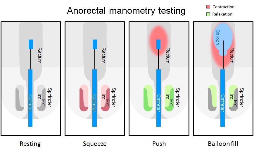 Anorectal manometry 
فحص يُجرى لتحديد مصدر المشاكل في الجهاز الهضمي السفلي، حيث يقوم بقياس الكفاءة الوظيفية لعضلات المستقيم وعضلات الشرج العاصرة.