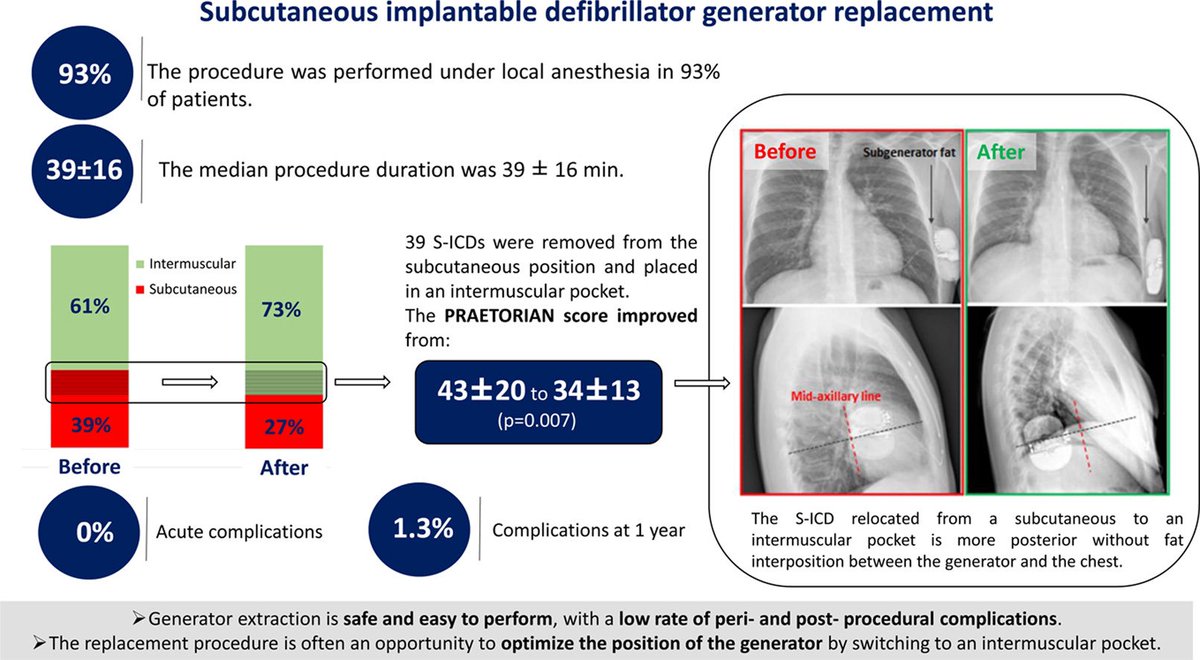 Another paper resulting from an important Italian collaboration that demonstrates the effectiveness and safety of S-ICD generator replacement. lnkd.in/eKMhVM8Q