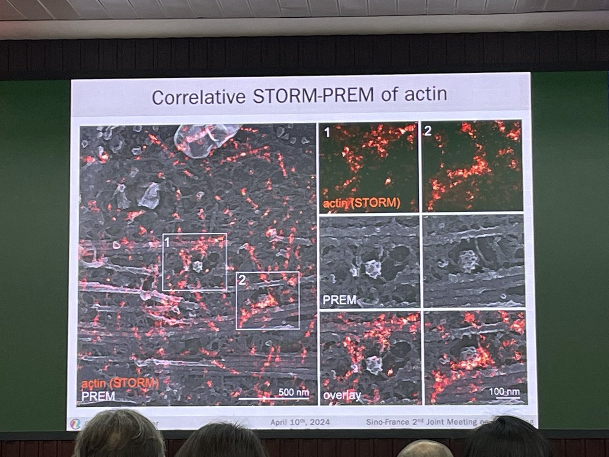 @christlet on stage at 2nd Sino French joint bioimaging meeting, impressive correlative STORM PREM images 😍!
