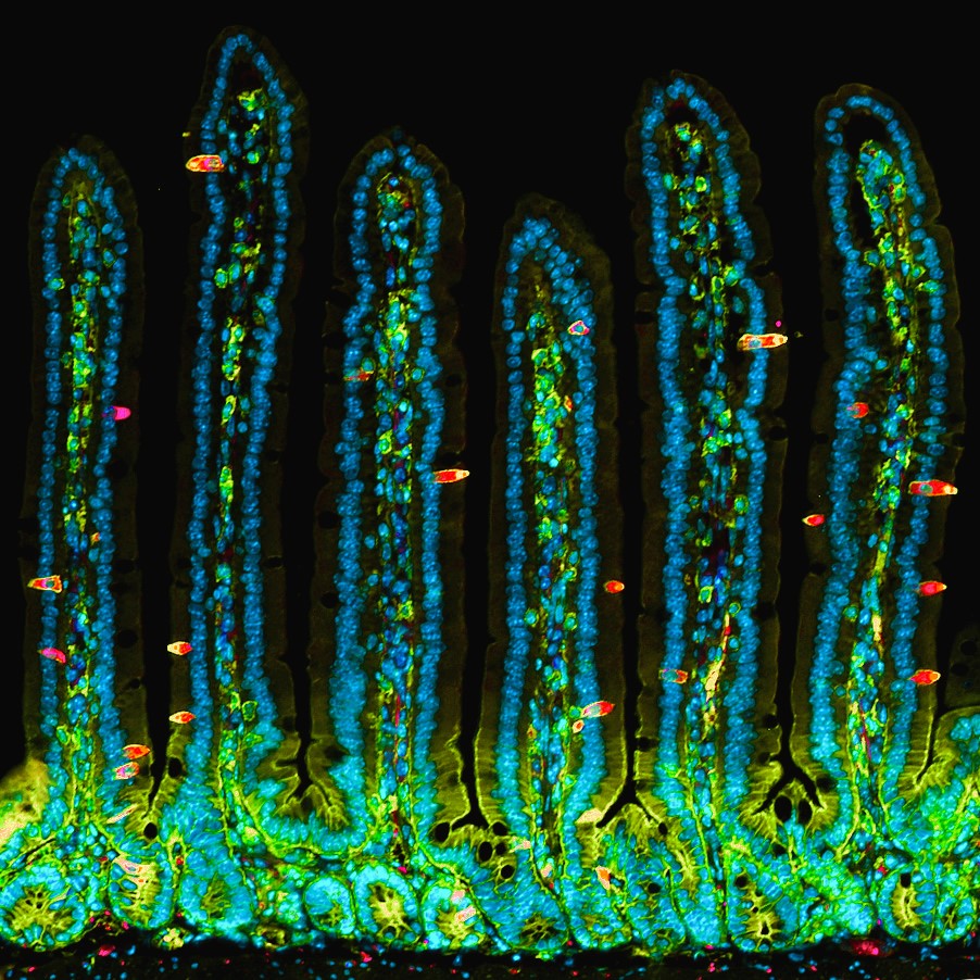 So many intestinal tuft cells...

#TuftTuesday #microscopy #bioart #sciart #pathart #histoart #intestine
