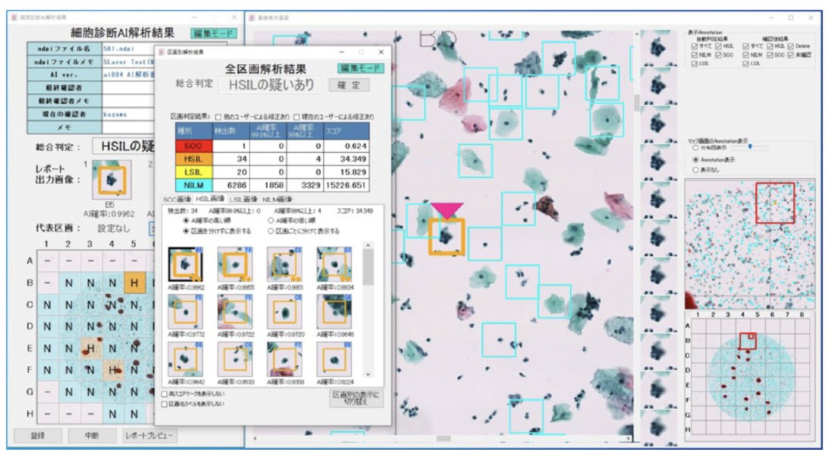 無償評価公開！！！ ｢子宮頸がん細胞診支援AI（無償評価公開）｣ ･ 子宮頸がん細胞診は、子宮頸部の細胞を採取して作成したスライドデータを顕微鏡で調べる検査 ･ 細胞検査士の診断支援を行い、負担軽減を目的 ･ デジタル化されたスライドデータでAIの評価が可能 cervical-cancer-demo.ai-cytology.com