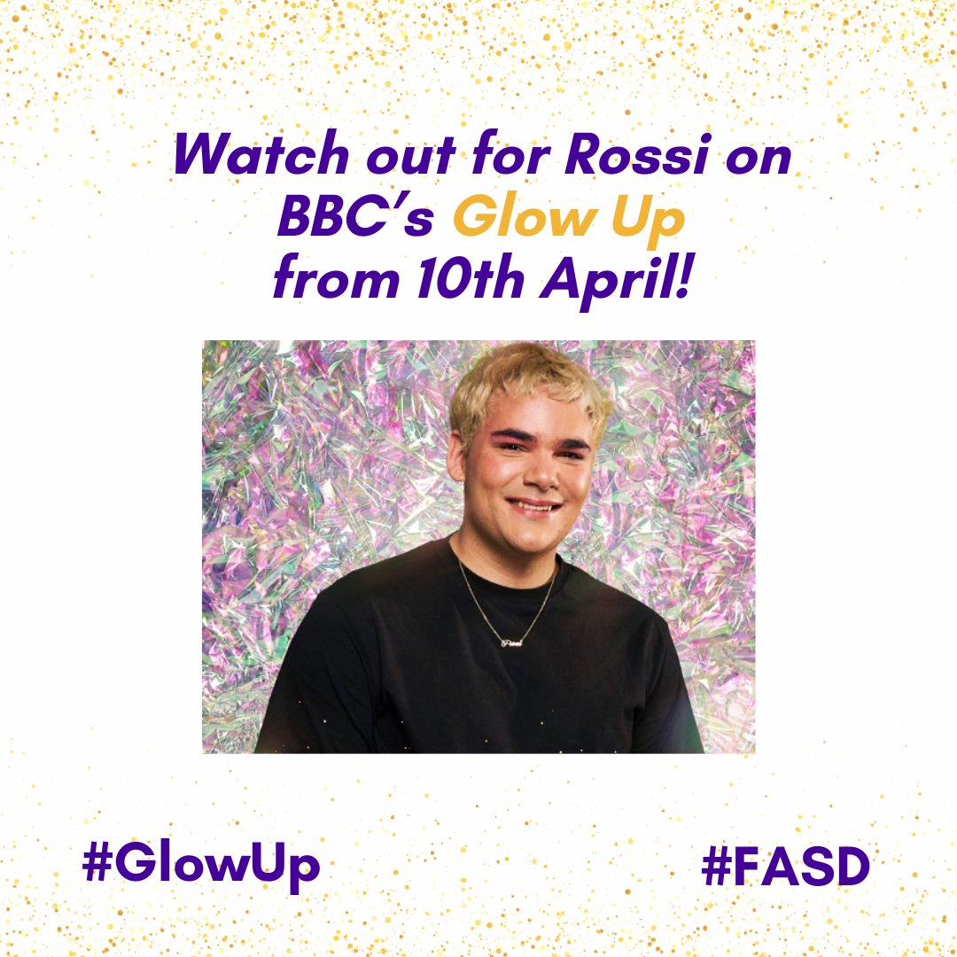 Congrats to Rossi who has made it on to @GlowUpBBC ! Breaking barriers and telling the world #FASD is no barrier! Show your support by tuning in tonight on BBC3. @Makeupbyrossino #GlowUp #FASD Watch a recent webinar the FASD Hub held with Rossi here: ow.ly/FjK350Rbczq