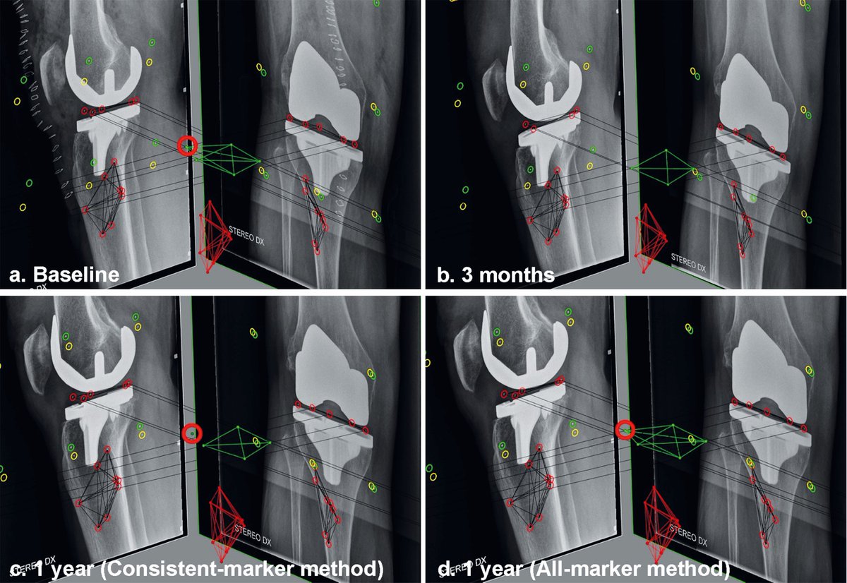 Acta Orthopaedica tweet media