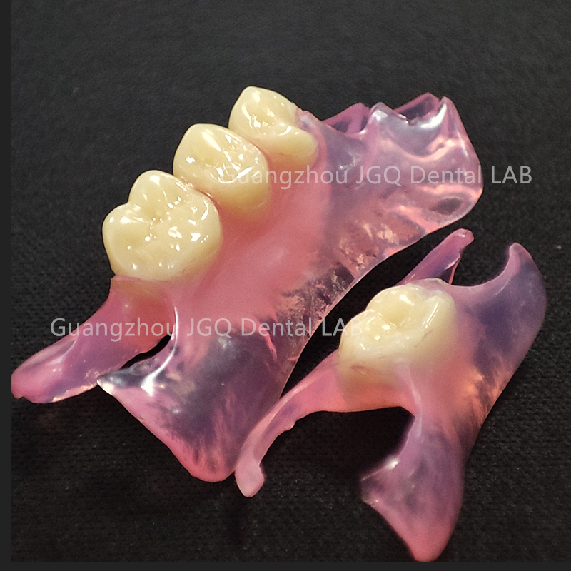 ZhaoJason57098's tweet photo. Flexible denture is very light, strong,durable. 

This allows the denture to feel more natural&amp;less bulky in mouth&amp;appear to be readily accepted by patients. 
#flexibledentures #acrylicdentures #dentallab

Guangzhou JGQ Dental Lab 
https://t.co/NBoq2jpnyl https://t.co/u3xmCAZ6vc