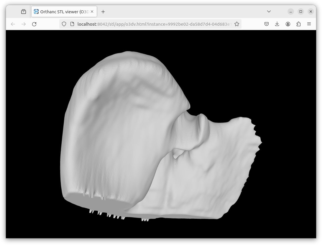 Introducing our latest plugin for Orthanc! Now you can encapsulate #STL files into #DICOM instances seamlessly, then display them using any Web viewer. STL files can also be automatically generated from DICOM structure sets (RT-STRUCT). orthanc.uclouvain.be/book/plugins/s…