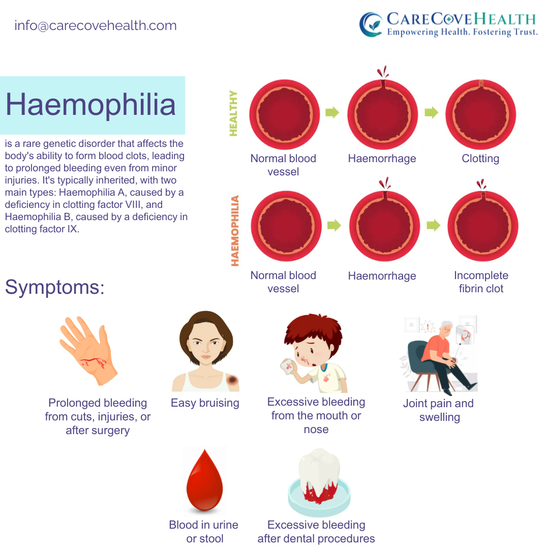 Untreated, hemophilia can be daunting. 
From prolonged bleeding to joint pain, understanding symptoms is key. Let's spread awareness, support, and hope this#WorldHaemophiliaDay. 💙 #KnowTheSigns #TreatmentMatters #WHD2024